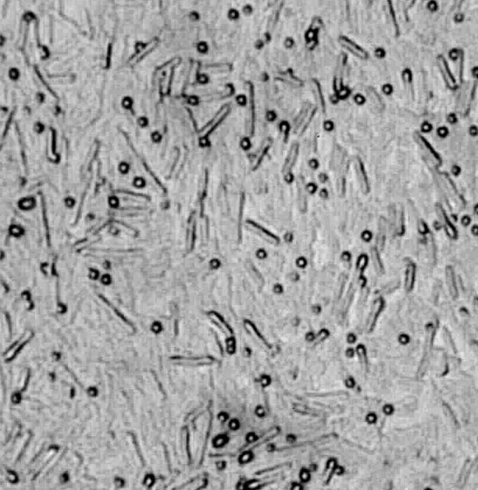 Quel est le rôle des spores dans la vie des bactéries? Mécanisme d'auto-préservation