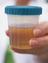 la protéine dans l'urine de l'enfant provoque