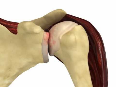 Classification des articulations humaines. Classification des joints par structure