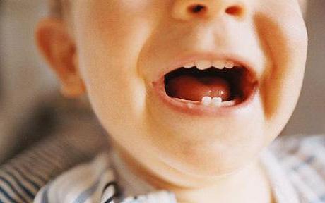 Les dents chez un enfant jusqu'à un an: que chercher pour des parents attentionnés